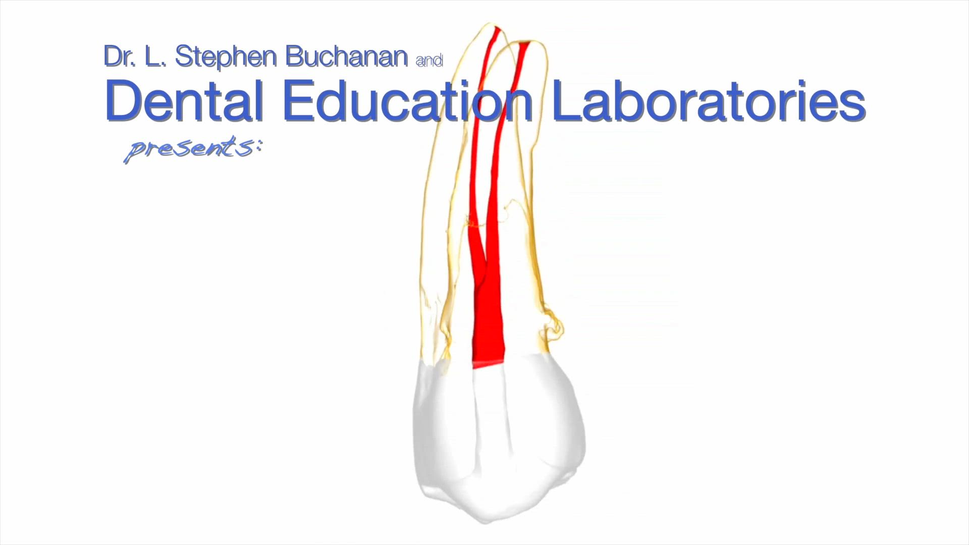 5. Access Exercise on Maxillary First Premolar #5 | Delendo Courses Online